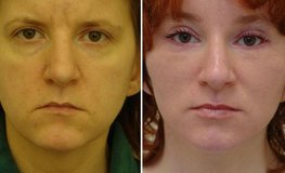 Фото до и после пластического омоложения лица и смена имиджа