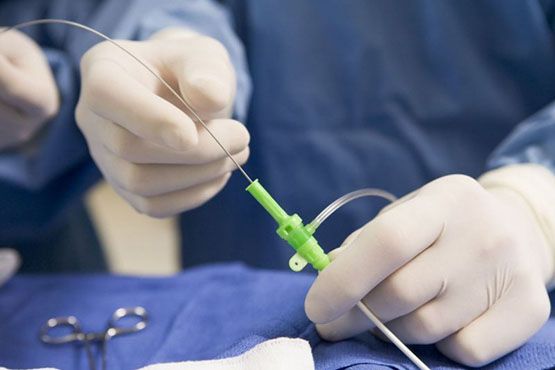 Операция без разреза: эндоскопия на службе у пластических хирургов