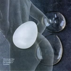 Виды имплантов для глютеопластики