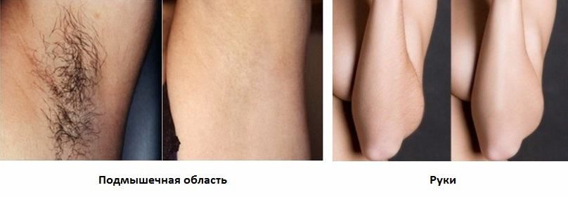 Фото до и после