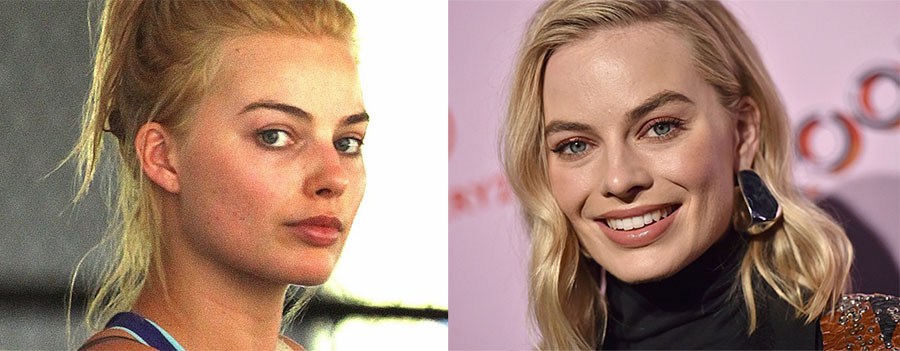 Марго Робби пластика носа