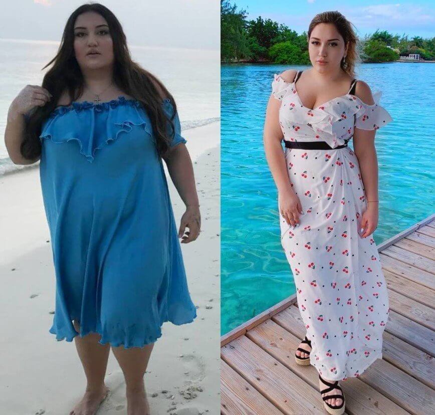 Гоар Аветисян до&nbsp;и&nbsp;после похудения