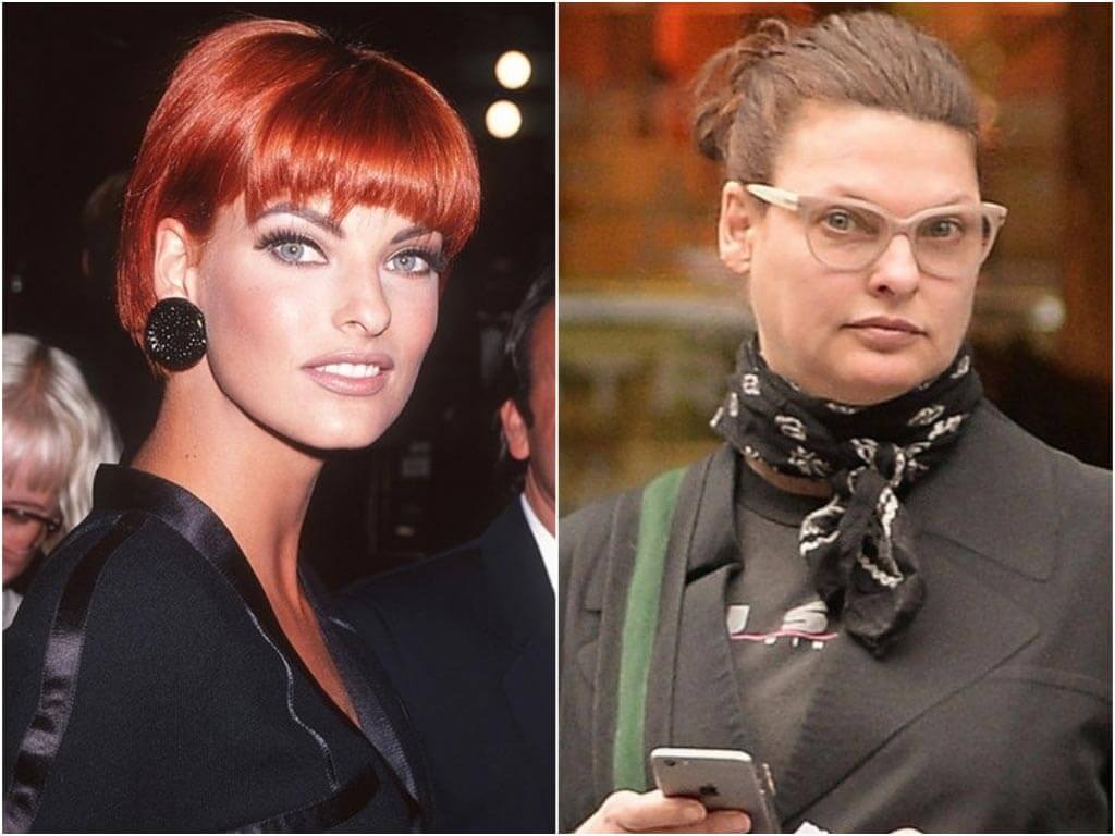 Линда Евангелиста до&nbsp;и&nbsp;после криолиполиза