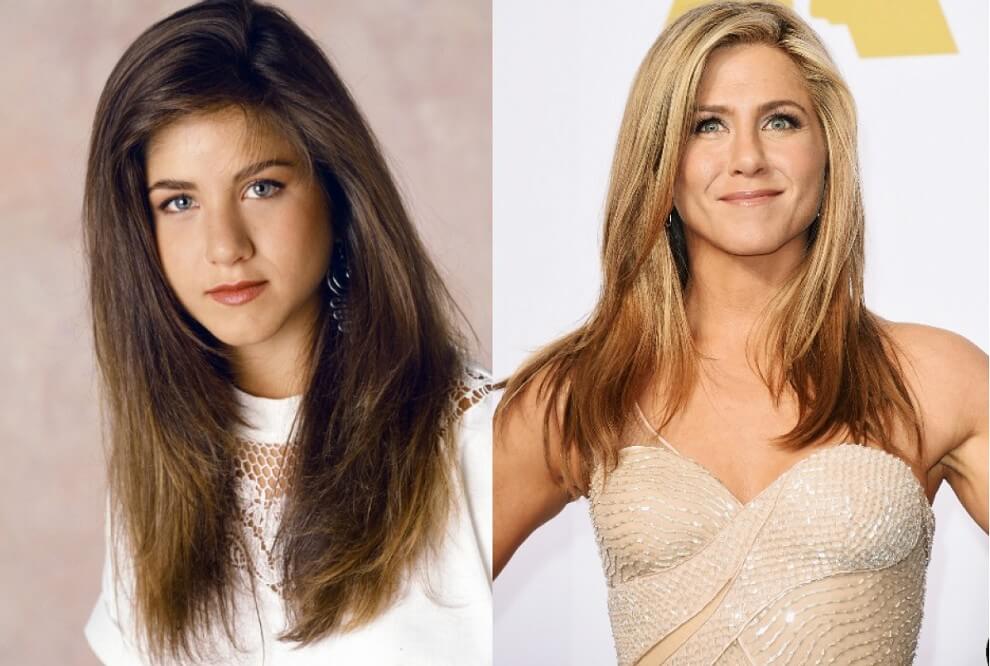  Дженнифер Энистон до&nbsp;и&nbsp;после ринопластики