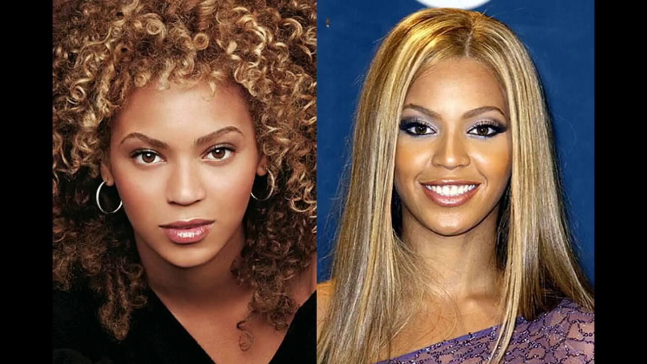 Бейонсе до&nbsp;и&nbsp;после ринопластики