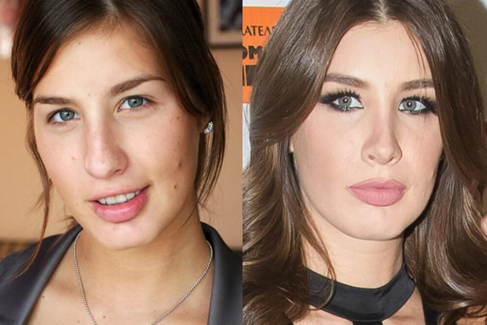 Кети Топурия до&nbsp;и&nbsp;после ринопластики