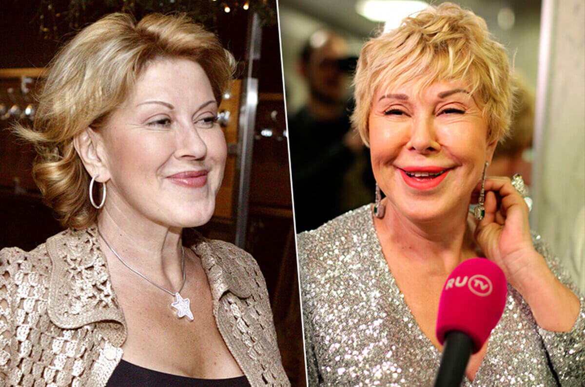 Любовь Успенская до&nbsp;и&nbsp;после пластики