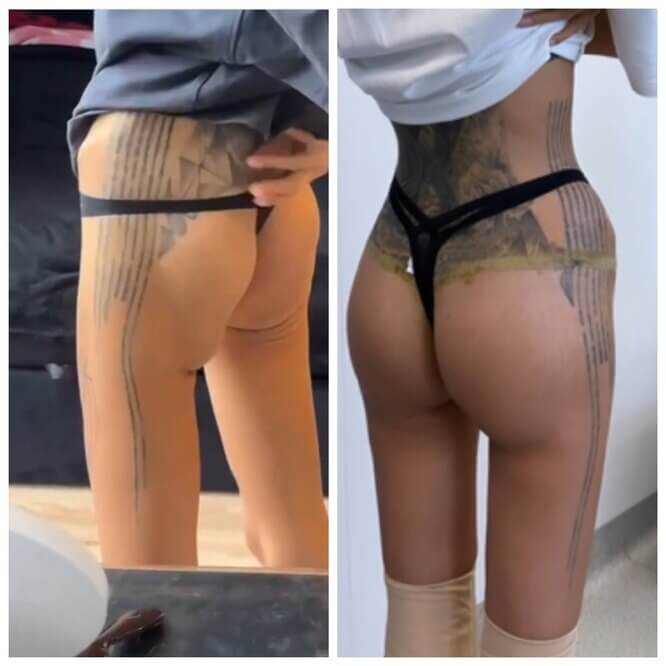 Алана Мамаева до&nbsp;и&nbsp;после коррекции ягодиц