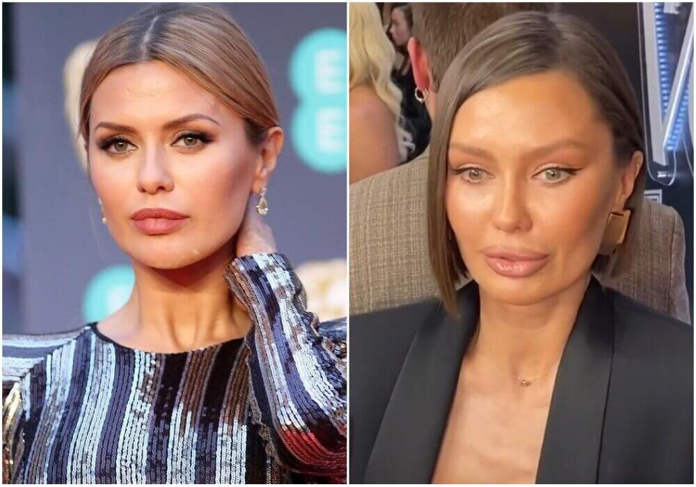 Виктория Боня до&nbsp;и&nbsp;после пластики в&nbsp;2023 году